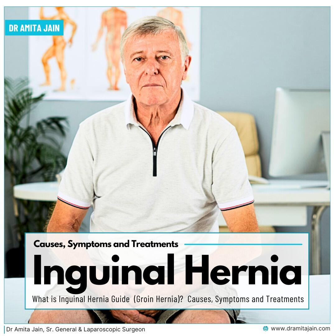 What is Inguinal Hernia Guide (Groin Hernia) : Causes, Symptoms and Treatments  